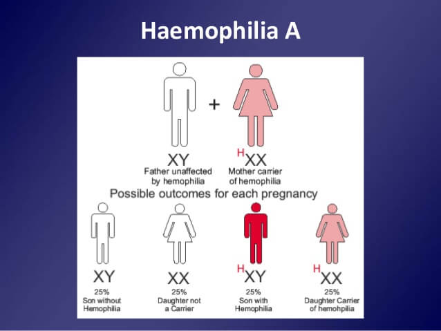 graphic representation of Hemophilia genetics