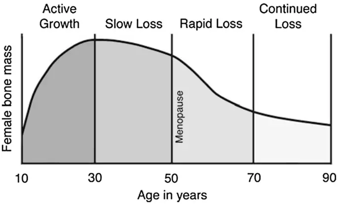 Figure X-2 Rate of bone loss through a woman’s lifetime