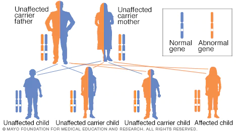 is down syndrome a dominant or recessive trait