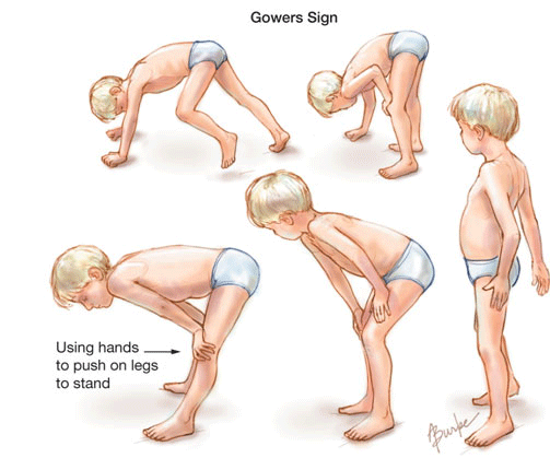 illustrated key features of DMD